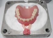Dotyczy tylko urządzeń J100 i J200 firmy Pressing Dental, nie jest to możliwe w innych wtryskarkach!).