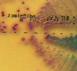 Urszula Nawrot et al. Evaluation of (BioRad) a chromogenic medium for yeasts differentiation Mikologia Lekarska 2005, 12 (4) b a c d Ryc. 1. Morfologia wzrostu grzybów na pod³o u : a) C.