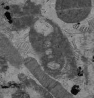 (Zedler), Kamienica III, wapienie