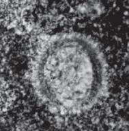 Borza, Puñców; C Carpistomiosphaera