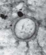 Kamienica I-II; F Colomisphaera radiata