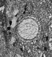 Mesoendothyra izjumiana Dain, Gumna; I