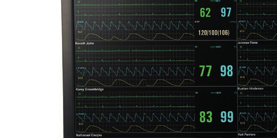 Centrala Vista 120 CMS System monitorowania pacjenta Łatwa w