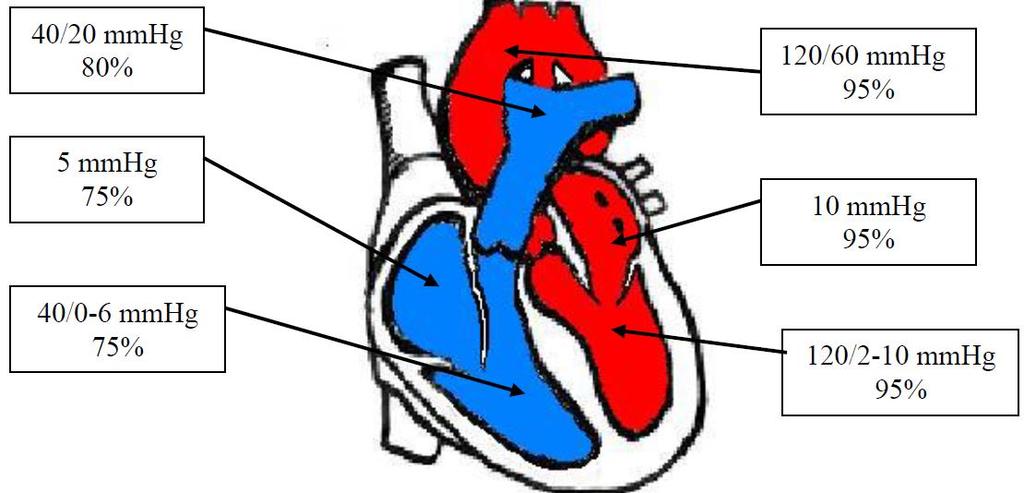 Następstwa hemodynamiczne: zależą od objętości przecieku i oporu naczyń płucnych. W warunkach prawidłowych ciś. skurczowe i rozkurczowe w aorcie jest 5-krotnie większe niż w t.