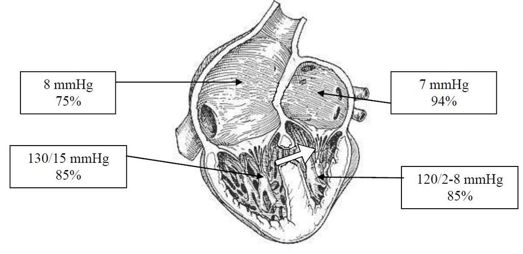 Definicja: Naczyniowa choroba płuc (pulmonary vascular disease- PDA) wtórna do dwukierunkowygo lub odwróconego prawo lewego przecieku na poziomie serca lub pni tętniczych wywołany wysokim