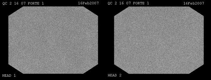 Kontrola jakości jednorodność pola Parametry ilościowe: Integral uniormity: Dierential uniormity: IU Max Max