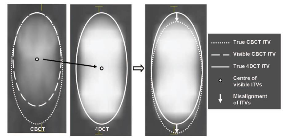 Planowanie 4D: pułapki Konieczna ocena amplitudy oraz regularności toru oddechowego CBCT to obraz 3-wymiarowy,