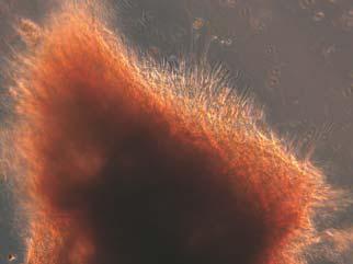 In the first one the own technique of collection, preparation, culturing and implanting of chondrocytes was prepared.