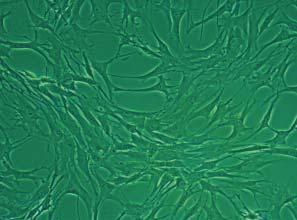 various environments. It has been showed, that chondrocytes isolated from young donors have greater vitality and preserve the capacity for division for longer.