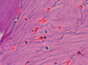 L-ascorbic acid. Chondrocytes adhered to the bottle within few hours after etching. Cells were then cultured in incubator at the temperature of 37 C in environment of 5.5 % of CO2 (Fig 2).