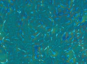 Technique of cryopreservation in fluid containing 10% of culturing medium (DMEM/HAM F12), 80% of blood serum (or FBS) and 10% of cryoprotectant (DMSO), was elaborated during development of culturing