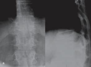 Ryc. 2.