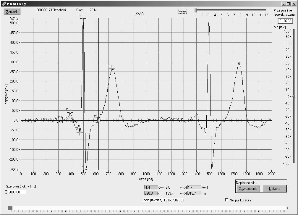 3.2. Pomiary EKG Program M_EKG umożliwia dokonywanie szczegółowych pomiarów zapisów badań, uśrednionych cykli oraz rytmu. Rys. 3 przedstawia przykładowe okno pomiarów.
