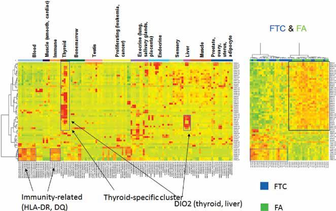 Left cluster of samples is relatively enriched in adenomas, while the right branch of dendrograms contains a large proportion of carcinomas Rycina 4.