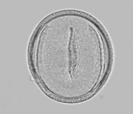 74 Magdalena Kluza-Wieloch A B C Ryc. 1. Budowa morfologiczna ziaren pyłku lnu zwyczajnego: A. zarys w położeniu biegunowym; powiększenie 400x, B. zarys w położeniu równikowym, powiększenie 400x, C.