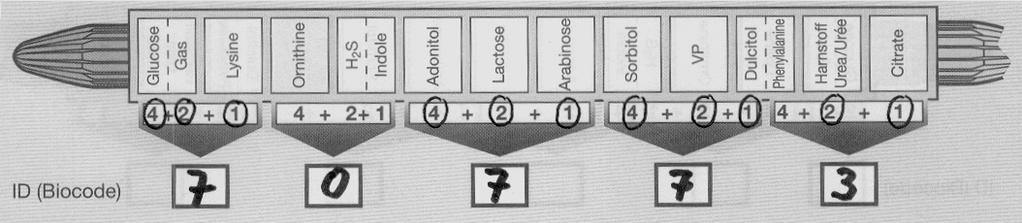 Enterotube II (A = baza danych z reakcją