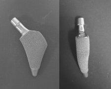 Kamiński P. et al. Migration of Short Stem Prosthesis of the Hip Joint MATERIAŁ I METODY Endoproteza Proxima to endoproteza krótkotrzpieniowa (Ryc. 1).