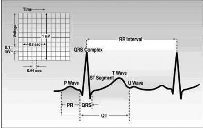 5. Metody rozwiązania problemu 5.1. Detekcja zespołu QRS Zespół QRS jest najbardziej charakterystycznym obiektem fali w elektrokardiogramie [Rys 4].