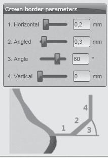 ZASTOSOWANIE Parametry krańcowe w oprogramowaniu CAD Stosując Ceramill Zolid Preshades należy zwrócić na to uwagę, aby parametry krańcowe zostały osiągnięte. Zalecane wartości to: _1.