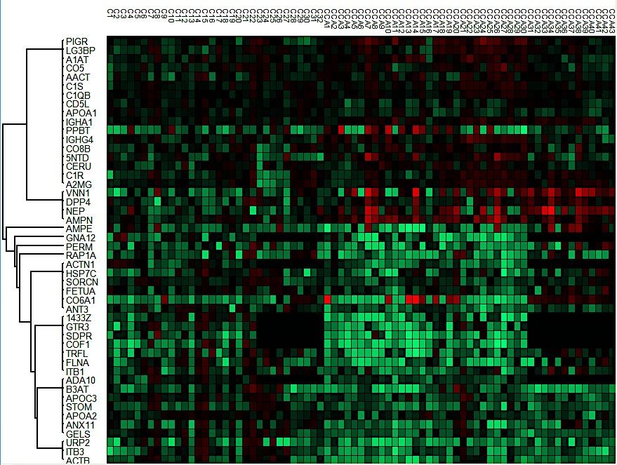Porównanie eksosomów: CCC vs. kontrole Control (n=43) CCA (n= 32) CCA (n=43) vs Control (n=32) CCA I-II (n=13) vs Control (n=22) Protein SEN SPE AUC p value Protein SEN SPE AUC p value AMPN 90.7 65.