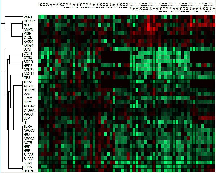 Porównanie eksosomów: PSC vs. kontrole Control n=43 PSC n=30 PSC (n=30) vs Control (n=32) Protein SEN SPE AUC p value AMPN 83.3 62.5 0.789 <0.001 FCN1 76.7 68.7 0.771 <0.001 NEP 63.3 90.6 0.761 <0.