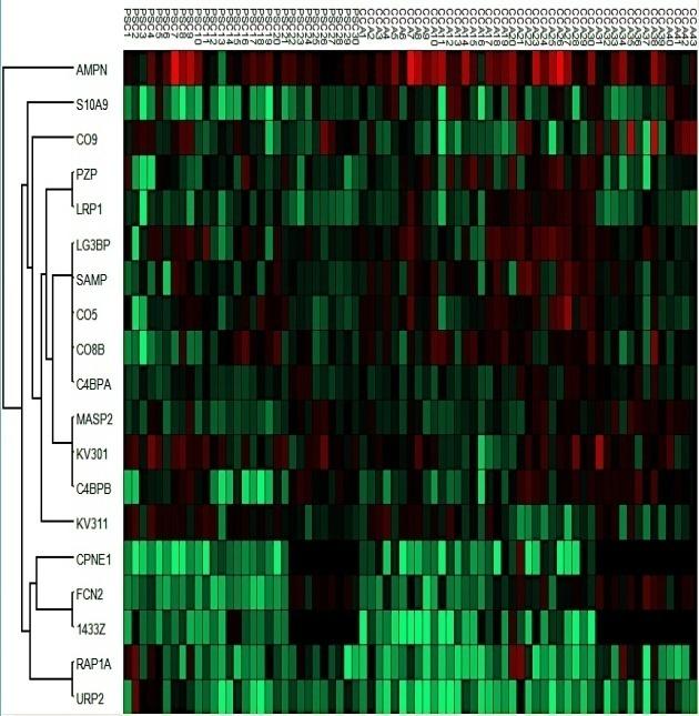 Porównanie eksosomów: PSC vs. CCC PSC n=30 CCA n= 32 Protein CCA (n=43) vs PSC (n=30) SEN SPE AUC p value Protein CCA I-II (n=13) vs PSC (n=30) SEN SPE AUC p value Fold change FIBG 88.4 63.3 0.796 <0.