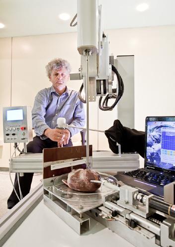 Zbigniew Nawrat pulator Robin Heart Vision umożliwia pokazanie pola operacyjnego podczas zabiegów endoskopowych, a manipulator Robin Heart umożliwia samo wykonanie operacji.