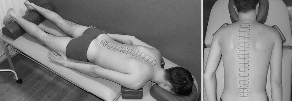 Pressure Pain Threshold), który określono za pomocą algometru elektronicznego Somedic typu 2 szwedzkiej produkcji (ryc. 2).