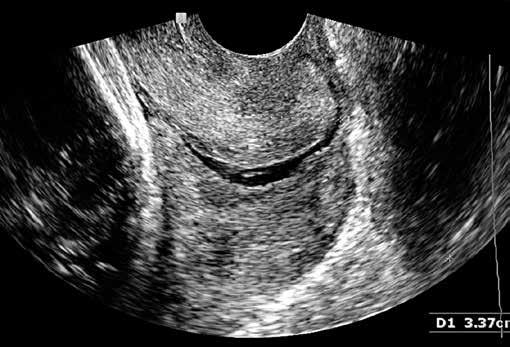 P R A C E O R Y G I N A L N E Discussion Conclusions Figure 1. Image of uterine cervix in B-mode. Figure 2.