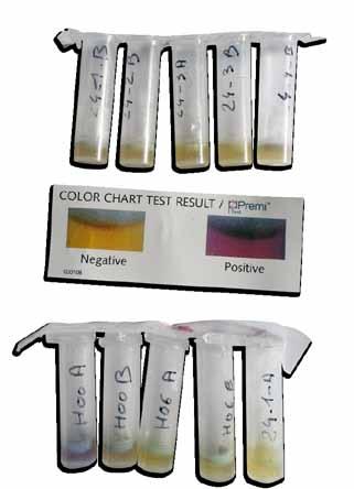 Zestaw do badania metodą Premi Test Opis zestawu do badania metodą Premi Test Premi Test to przesiewowe badanie mikrobiologiczne dla wykrycia pozostałości antybiotyków w różnych produktach