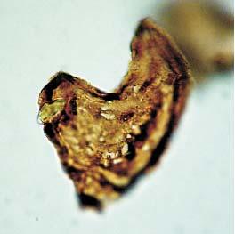 Impletosphaeridium varispinosum;k
