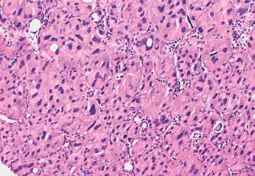 Microscopic images of cervical lymph nodes: in two cases the authors observed slight lacunar reaction, and in one rat a lacunar and follicular reaction.