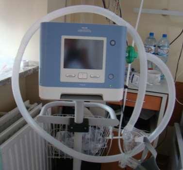 Potwierdzono wskazana do NWM Zmienne ciśnienie wdechowo-wydechowe (IPAP = 9 cmh 2 0, EPAP = 4 cmh 2 O, liczba oddechów 18/min.