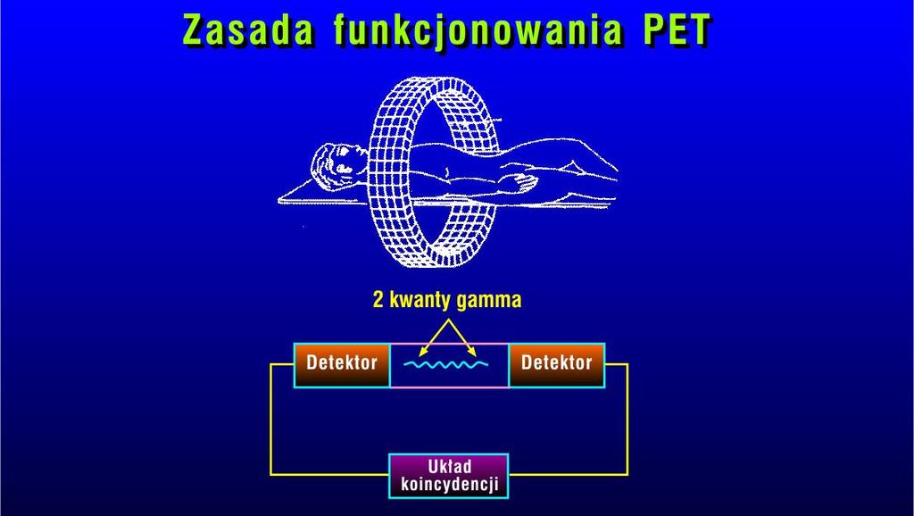 Pozytonowa tomografia emisyjna (PET) Radionuklid 18 F 15 O 11 C 13 N 82 Rb T 1/2 [min] - 109,8-2,0-20,4-9,97-1,27 Główne korzyści: możliwość badań przy użyciu naturalnych związków występujących w