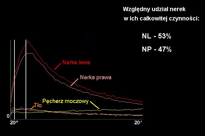 Krzywe