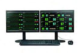 Vista 120 S 03 Powiązane produkty Centrala Vista 120 CMS Łatwa w obsłudze centrala Vista 120 CMS umożliwia centralne monitorowanie przyłóżkowe parametrów życiowych do 64 pacjentów