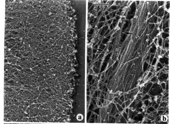 Filamenty aktynowe Filamenty aktynowe w fibroblastach REF-52