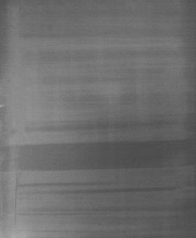 Dzięki zaawansowanym aplikacjom Tomosynthesis oraz Dual Energy wykorzystującym specjalne techniki akwizycji można uzyskać lepszą wizualizację umieszczonych głębiej zmian patologicznych.