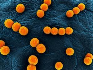 90-365 000 jtk/100 ml b) bakterie Escherichia coli.