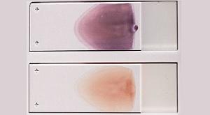 2. Bernard KG., Cooperberg PL. Sonographic differentiation between blighted ovum and early viable pregnancy. AJR 1985; 144:597-602 3. Allison JN. et al.