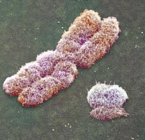 Chromosomy X i Y Chromosom X: 5% haploidalnego genomu kilka tysięcy genów geny metabolizmu podstawowego Chromosom Y: 2-3% haploidalnego