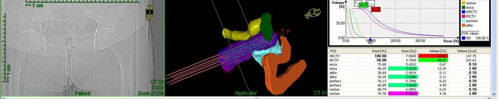 CT/MR Multi Channel + 2