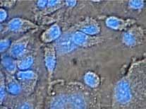 XX wieku odkryto istnienie hematopoetycznej komórki macierzystej (ang. hematopoietic stem cell, HSC), która daje początek wszystkim komórkom krwi.