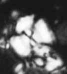 II