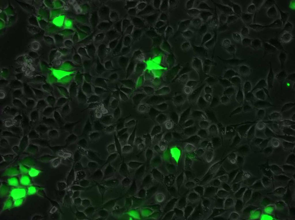 DU-145 PROSTATE CARCINOMA CELLS