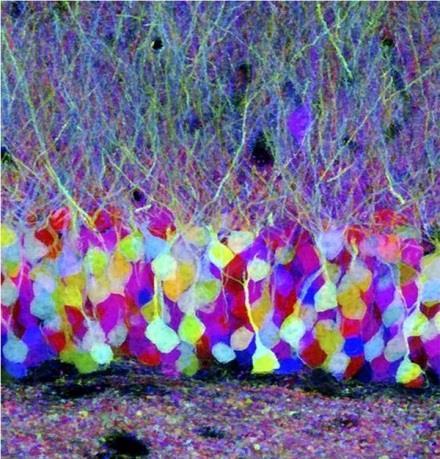 Neuroscience [neuronauka] może być jak sztuka Neurons or Pollock?