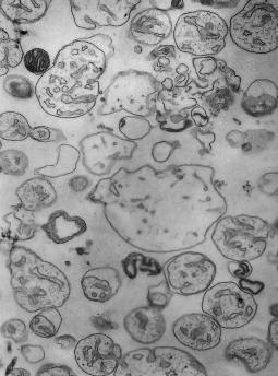 Mitochondrialny megakanał w fizjologii i patologii komórki nowe spojrzenie Mitochondrialny megakanał jest skomplikowaną strukturą białkową, która tworzy się w miejscu bliskiego kontaktu zewnętrznej i