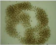 Colonieswith diameters<20 µm scarcelymigrate, colonieswith diameters<160 µm accomplishless thanone