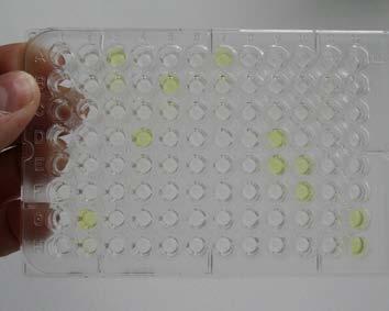 3. Ocena presji infekcyjnej PVY, PLRV, PVS, PVM i PVX na podstawie badań diagnostycznych pobranych prób bulw ziemniaka w próbie oczkowej z wykorzystaniem testu D-ELISA Porażenie wirusami prób