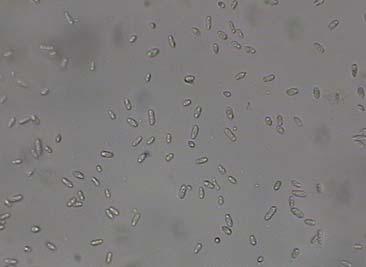 Chlamydospores were not observed. Phot. 5. Pycnidia of P. nepeticola (L 284) 125 (a) photo E.
